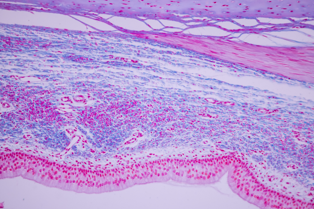 6 Essential Steps to Protect Your Endothelial Glycocalyx Today
