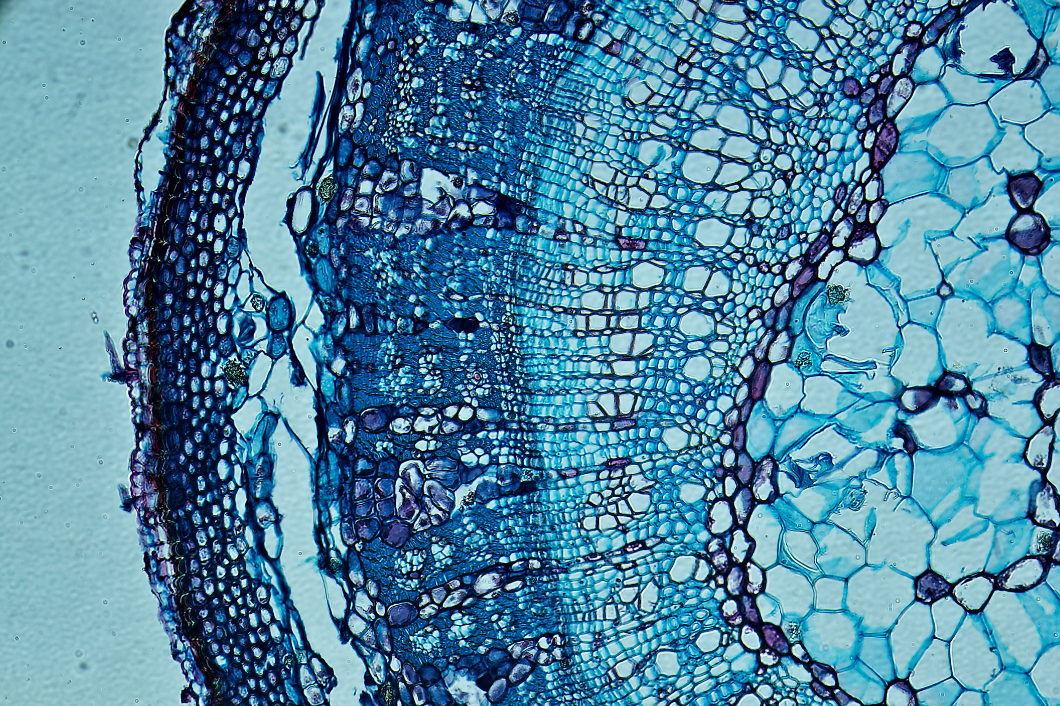 Why Arterosil HP® with MonitumRS® is the Best Endothelial Glycocalyx (EGX) support