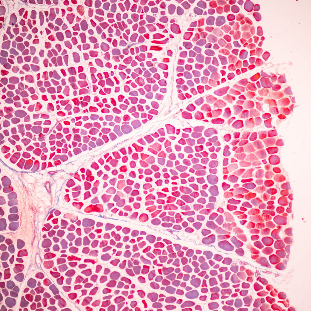 Women’s Midlife Hormonal Changes and the Gut-Hormone-Bone Axis
