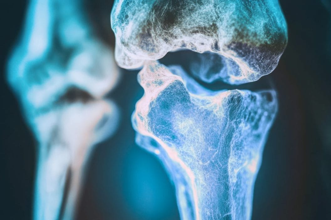 How Joints Work, Why Cartilage Matters, and What Causes Discomfort